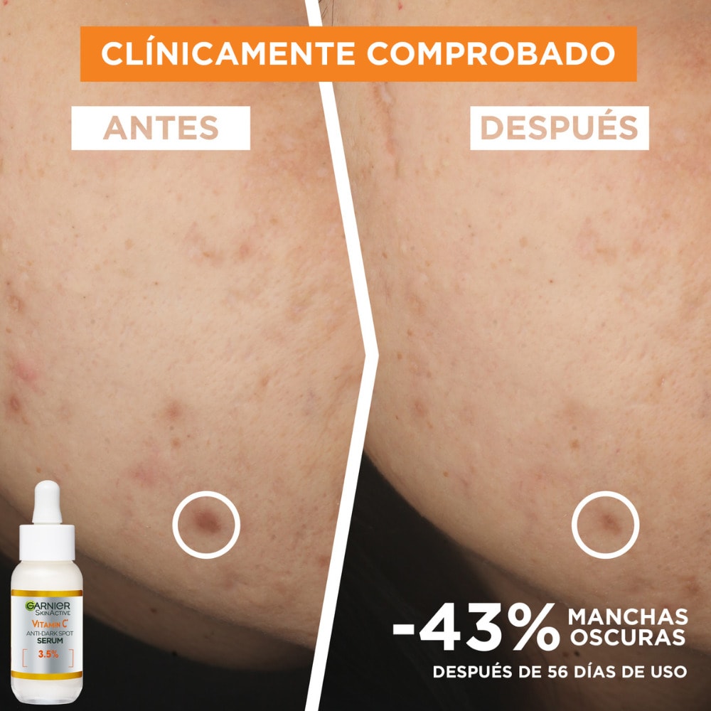 serum express aclara vitamina c ganier viral beauty